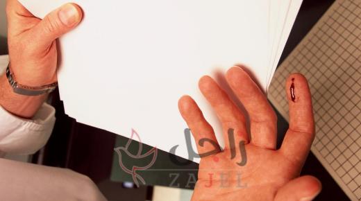 لماذا نتألم بشدة من جرح حواف الورق أكثر من الجروح العميقة؟