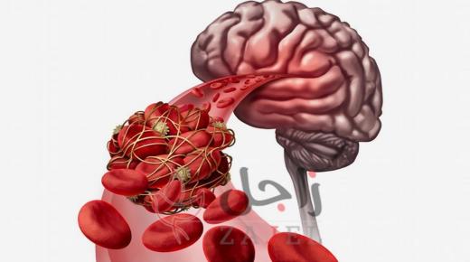 من فوائد الصوم.. تصغير المعدة