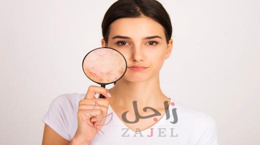 كيف تعرفين أنّ البشرة دهنية