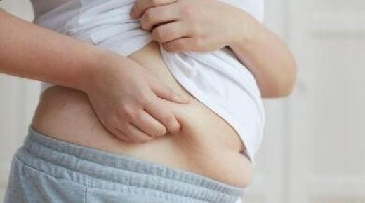 الجراحة الذهبية لعلاج السمنة