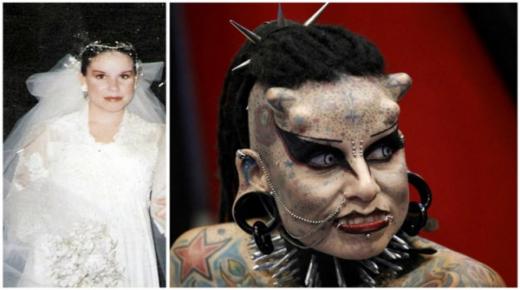 شاهد أغرب 10 أشخاص يمتلكون صفات جسدية فريدة بينهم” مصاصة دماء”