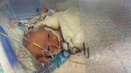 بعد 5 أشهر في المستشفى.. “الرضيع الشفّاف” ينجو بأعجوبة!