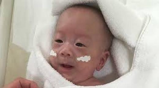 أصغر طفل خديج في العالم يحتفل بعيد ميلاده الأول