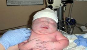 ما تحتاج النساء معرفته عن حكاية الطفل (العملاق) على تيك توك