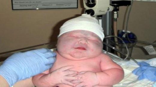 ما تحتاج النساء معرفته عن حكاية الطفل (العملاق) على تيك توك