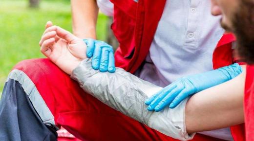 علاج الحروق في المنزل حسب الحالة