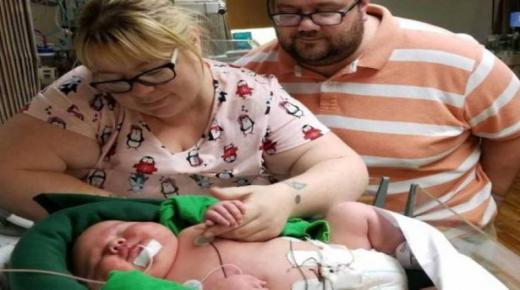 مولود يحطم رقما قياسيا في أميركا ويذهل الأطباء