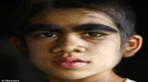 بشر مستذئبون