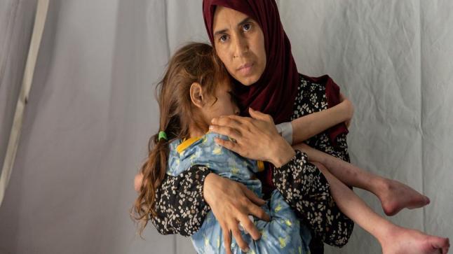 يونيسف: 28 طفلا يستشهدون بغزة يوميا جراء القصف والتجويع