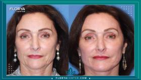 حافظ على مظهرك الخارجي مع التقدم بالسن