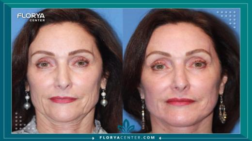 حافظ على مظهرك الخارجي مع التقدم بالسن