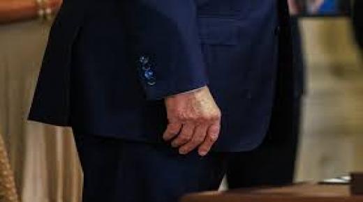 كدمة جديدة على يد ترمب تثير التكهنات مجددا حول صحته