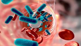 ارتفاع عالمي للإصابات بمرض قاتل يدخل ضمن أبرز 10 أسباب للوفيات