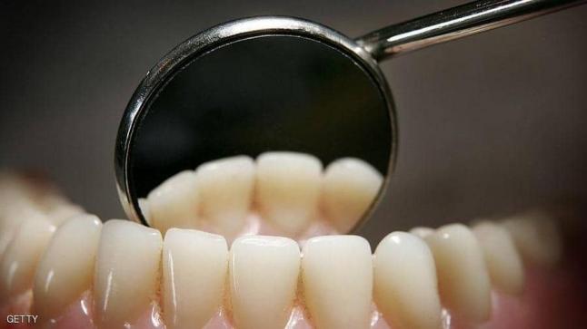 الطب الصيني يقدم الحل لعلاج “مينا الأسنان”